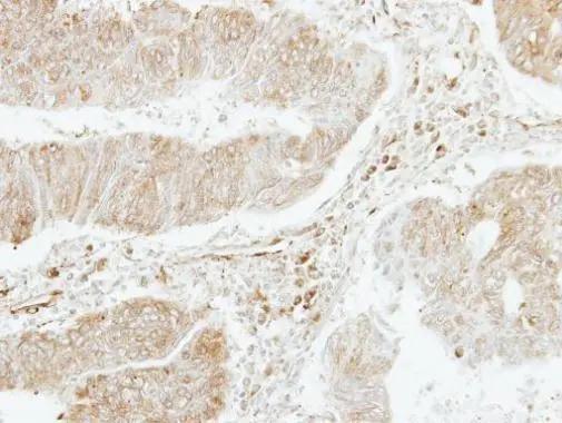 CXCL4L1 Antibody