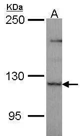Puratrophin-1 Antibody
