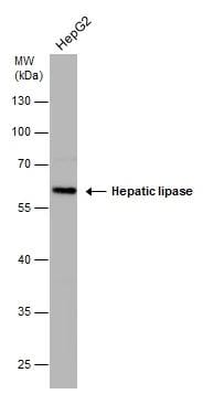 LIPC Antibody