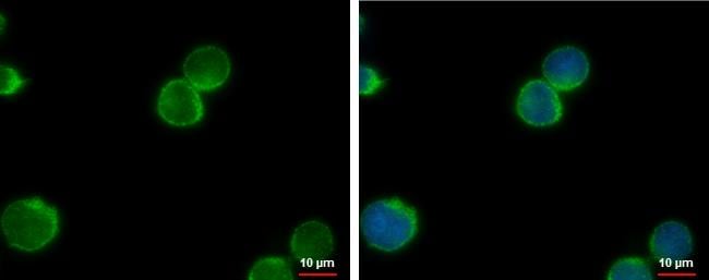 NEK1 Antibody