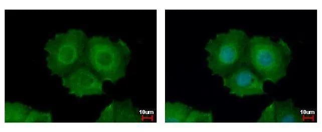 Keratin 31 Antibody