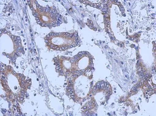 Keratin 31 Antibody