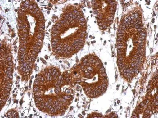 GANC Antibody