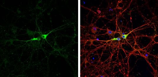 GAD1/GAD67 Antibody
