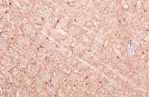 GAD1/GAD67 Antibody