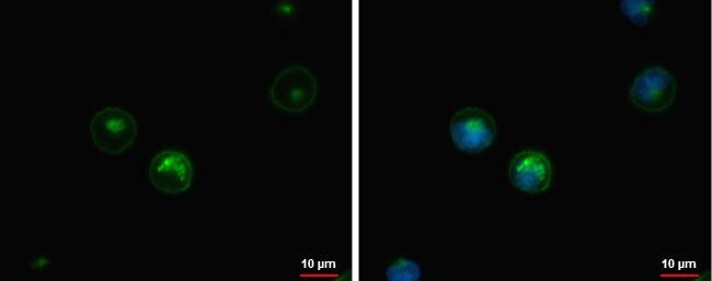 HLA DQB1 Antibody