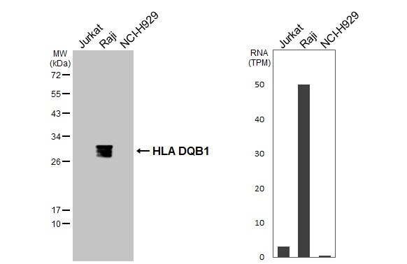 HLA DQB1 Antibody