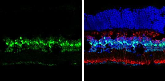 p27/Kip1 Antibody