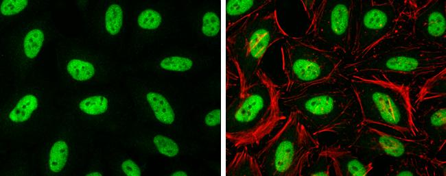 Histone H3.3B Antibody