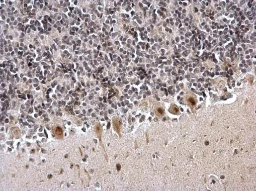 ZNF545 Antibody