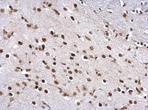 ZNF545 Antibody