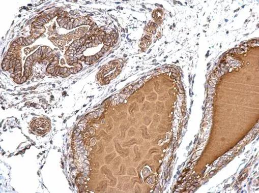PJA2/Praja2 Antibody
