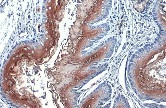PJA2/Praja2 Antibody