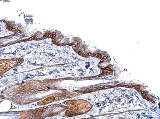 PCDHB1 Antibody
