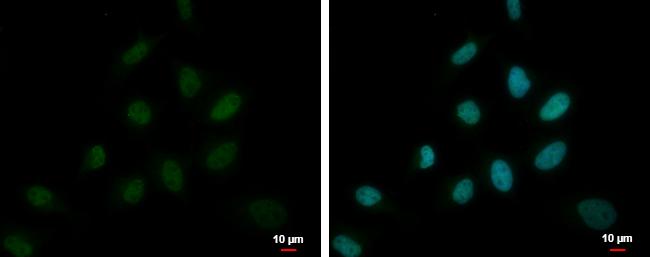 DEPDC1A Antibody