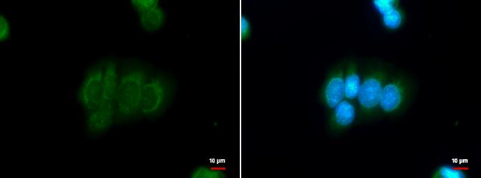 DBC1 Antibody