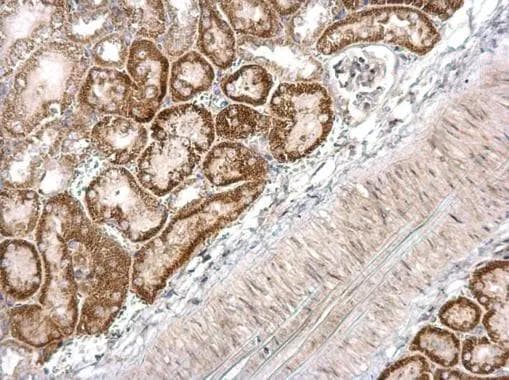DBC1 Antibody