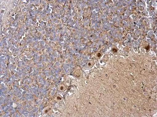 DBC1 Antibody