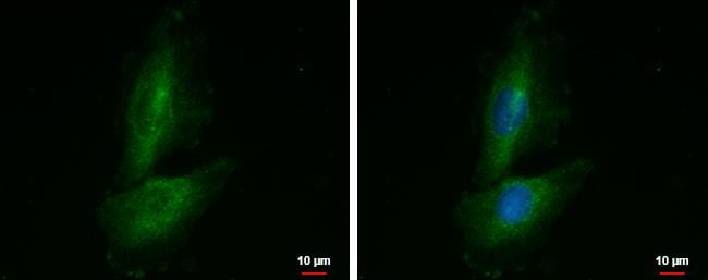 Proline rich 16 Antibody
