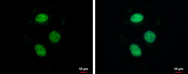 ZNF599 Antibody