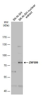 ZNF599 Antibody