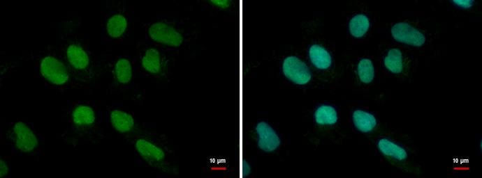 MEF2B Antibody