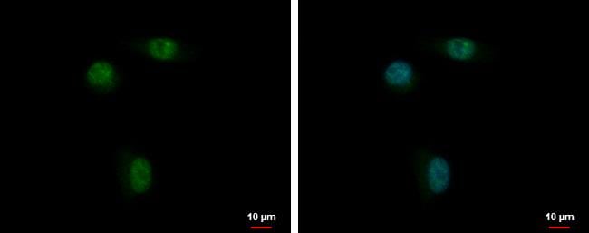 ANKRD23 Antibody