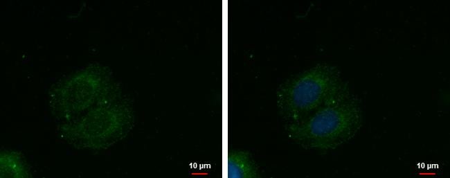 METTL19 Antibody