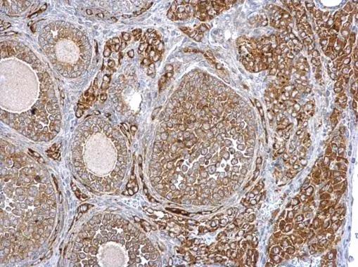 SYTL4 Antibody