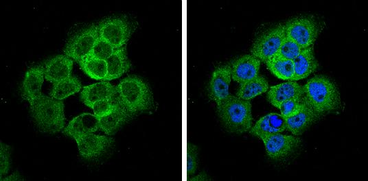 AMOTL2 Antibody