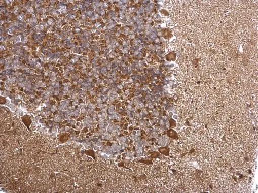 TRAPPC2L Antibody