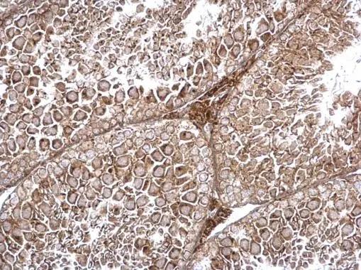 TRAPPC2L Antibody