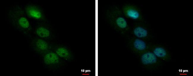 BOD1L Antibody
