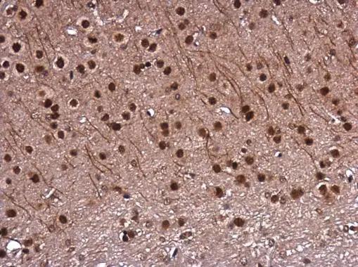 DNTTIP1 Antibody
