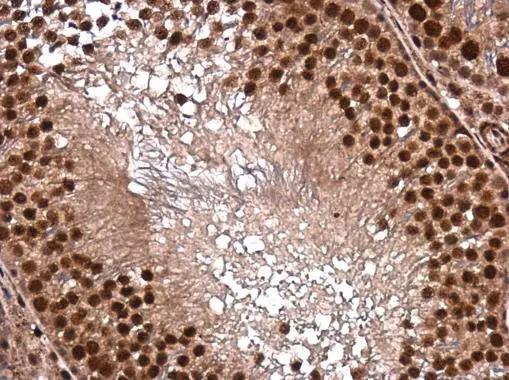 DNTTIP1 Antibody
