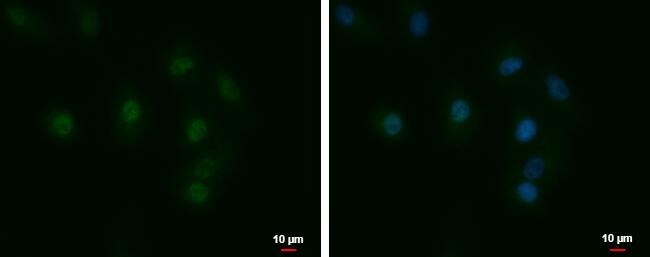LCMT1 Antibody