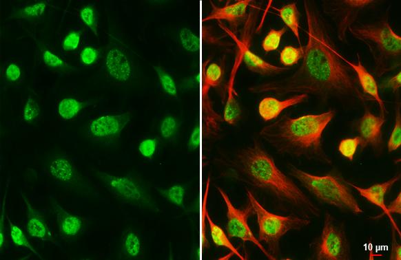 SETDB1 Antibody (HL3260)