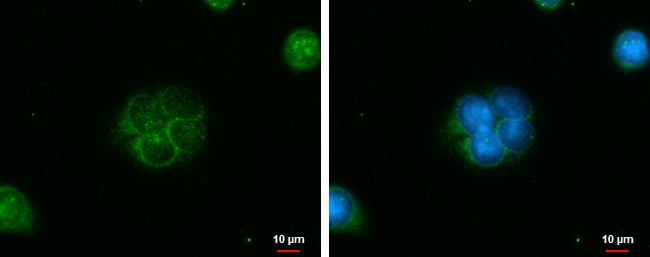 IQCC Antibody