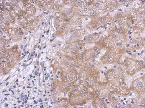 Kelch-Like Family Member 21 Antibody