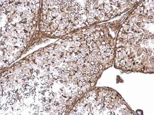 RAB11FIP4 Antibody