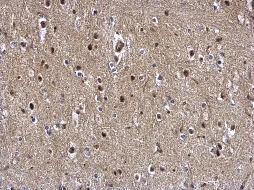 ZBTB5 Antibody