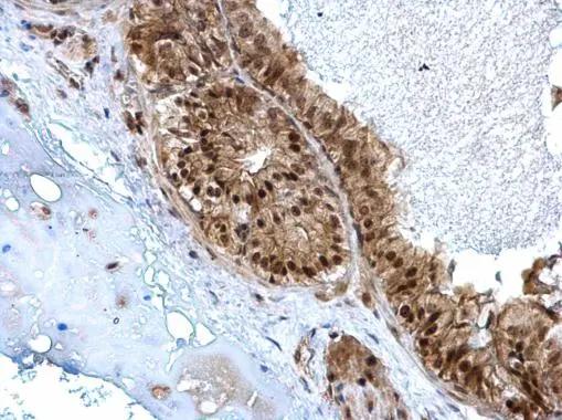 ZBTB5 Antibody