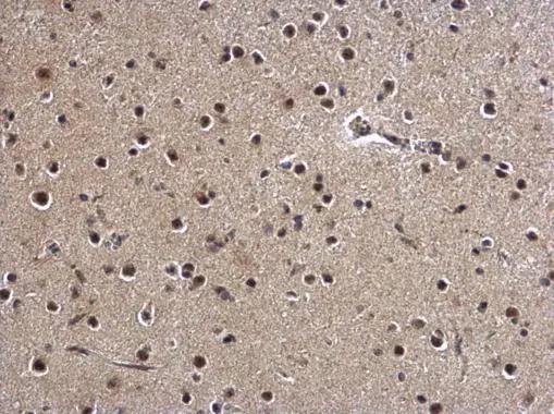 ZBTB5 Antibody