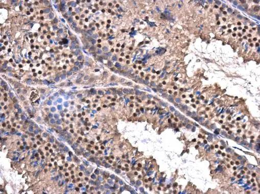 ZBTB5 Antibody