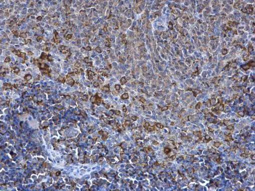 SPATA13 Antibody