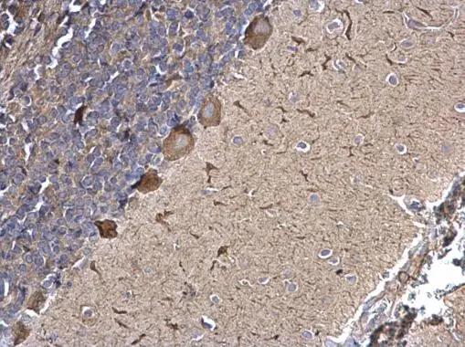 SPATA13 Antibody