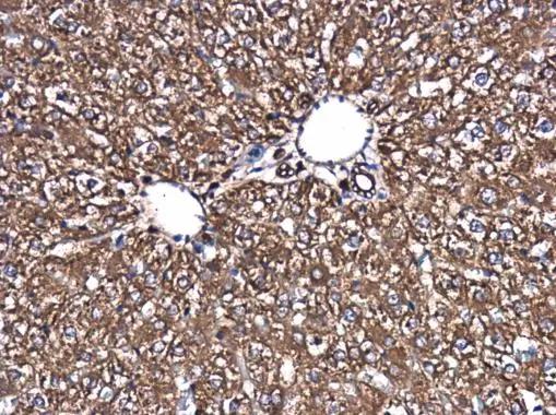 SPATA13 Antibody