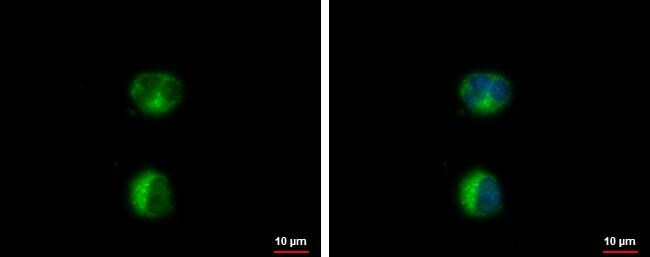 HEATR2 Antibody