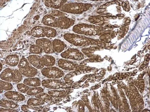 VEPH1 Antibody