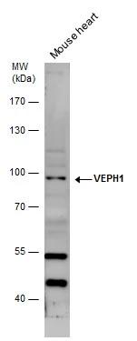 VEPH1 Antibody